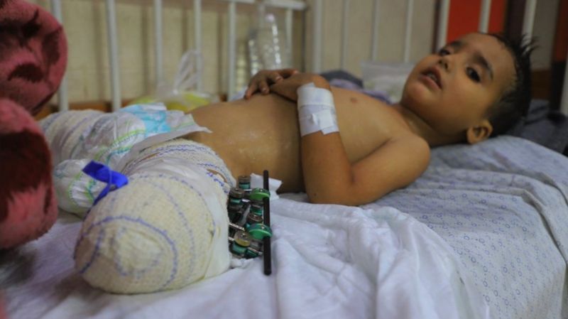 “Niño herido, familia no sobrevivió”: WCNSF, la desoladora descripción de cientos de niños que quedaron huérfanos en Gaza