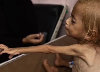 Los muertos por desnutrición en Gaza superan los 250; 108 son niños