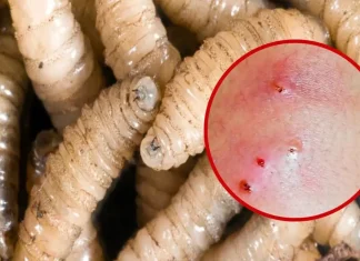 Detectan el primer caso en humanos en EE.UU. del gusano barrenador del Nuevo Mundo