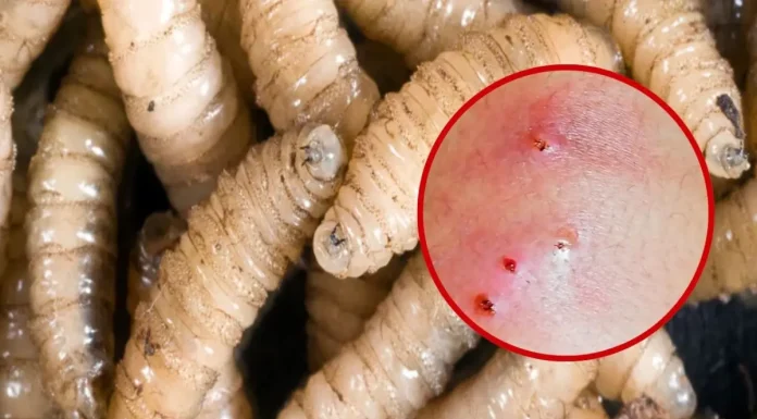 Detectan el primer caso en humanos en EE.UU. del gusano barrenador del Nuevo Mundo