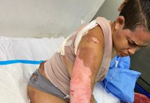 INDIGNACIÓN: SOBREVIVIENTE DE EXPLOSIÓN DENUNCIA IMPUNIDAD POR “DINERO Y APELLIDO” TRAS PERDER A SU MADRE