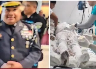 Coronel de la Policia Nacional resulta con quemaduras graves en incendio en destacamanto policial