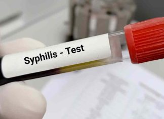 Casos de sífilis en adultos aumentaron en las Américas