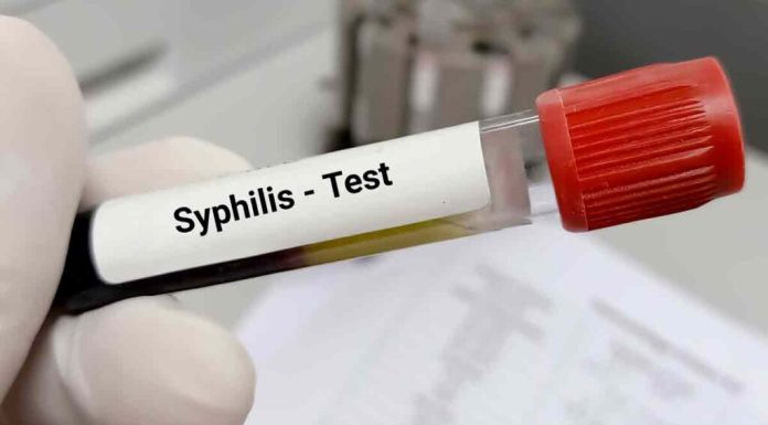Casos de sífilis en adultos aumentaron en las Américas