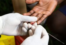 RD tiene más de 85 mil personas viviendo con VIH; COIN realizará pruebas gratuitas del 17 al 23 de noviembre