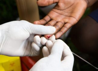 RD tiene más de 85 mil personas viviendo con VIH; COIN realizará pruebas gratuitas del 17 al 23 de noviembre