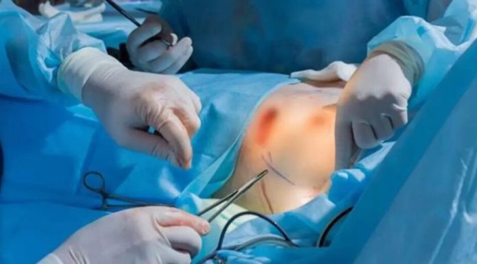 Cirujano impulsa la mamoplastia de reducción como cirugía de salud en la República Dominicana
