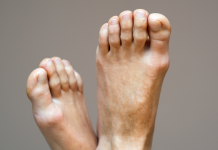 ¡Adiós, sicote! Los verdaderos consejos para eliminar el hedor en los pies