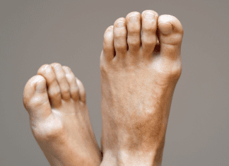 ¡Adiós, sicote! Los verdaderos consejos para eliminar el hedor en los pies