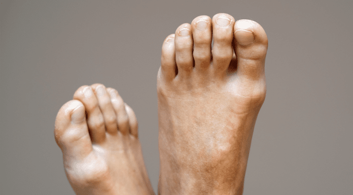 ¡Adiós, sicote! Los verdaderos consejos para eliminar el hedor en los pies