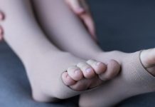 La pesadez e hinchazón de piernas pueden ser una señal de complicación vascular