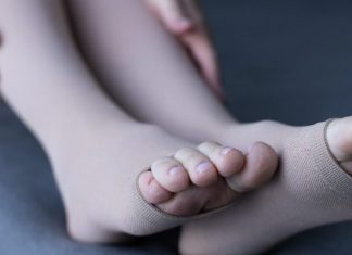 La pesadez e hinchazón de piernas pueden ser una señal de complicación vascular