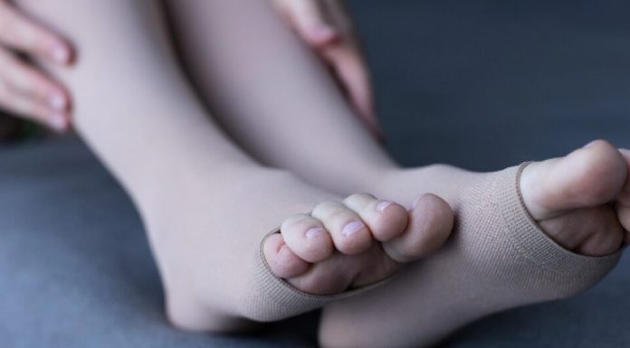 La pesadez e hinchazón de piernas pueden ser una señal de complicación vascular