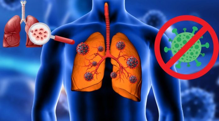 Alertan sobre alto costo de la fibrosis quística en RD y llaman a fortalecer apoyo estatal