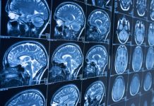 Diferencias entre Parkinson y temblor esencial: cómo identificar cada uno y cuándo acudir al médico