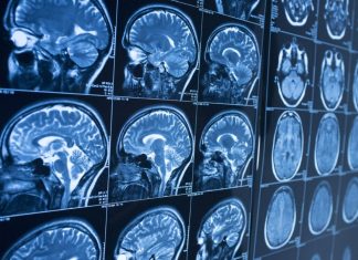 Diferencias entre Parkinson y temblor esencial: cómo identificar cada uno y cuándo acudir al médico
