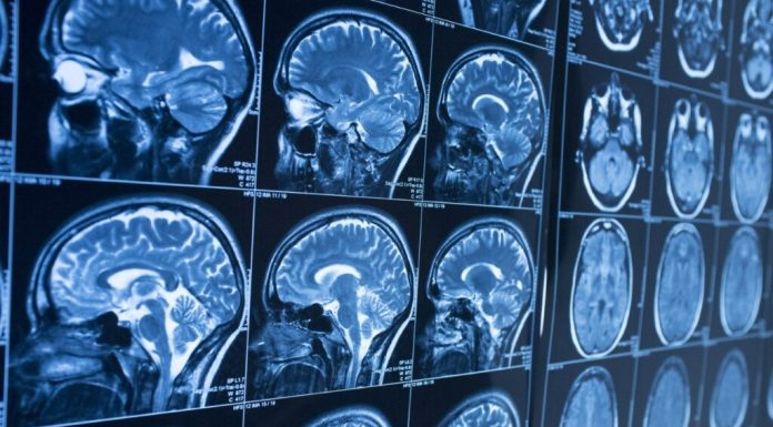 Diferencias entre Parkinson y temblor esencial: cómo identificar cada uno y cuándo acudir al médico